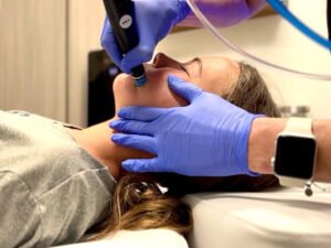 HydraFacial Treatment