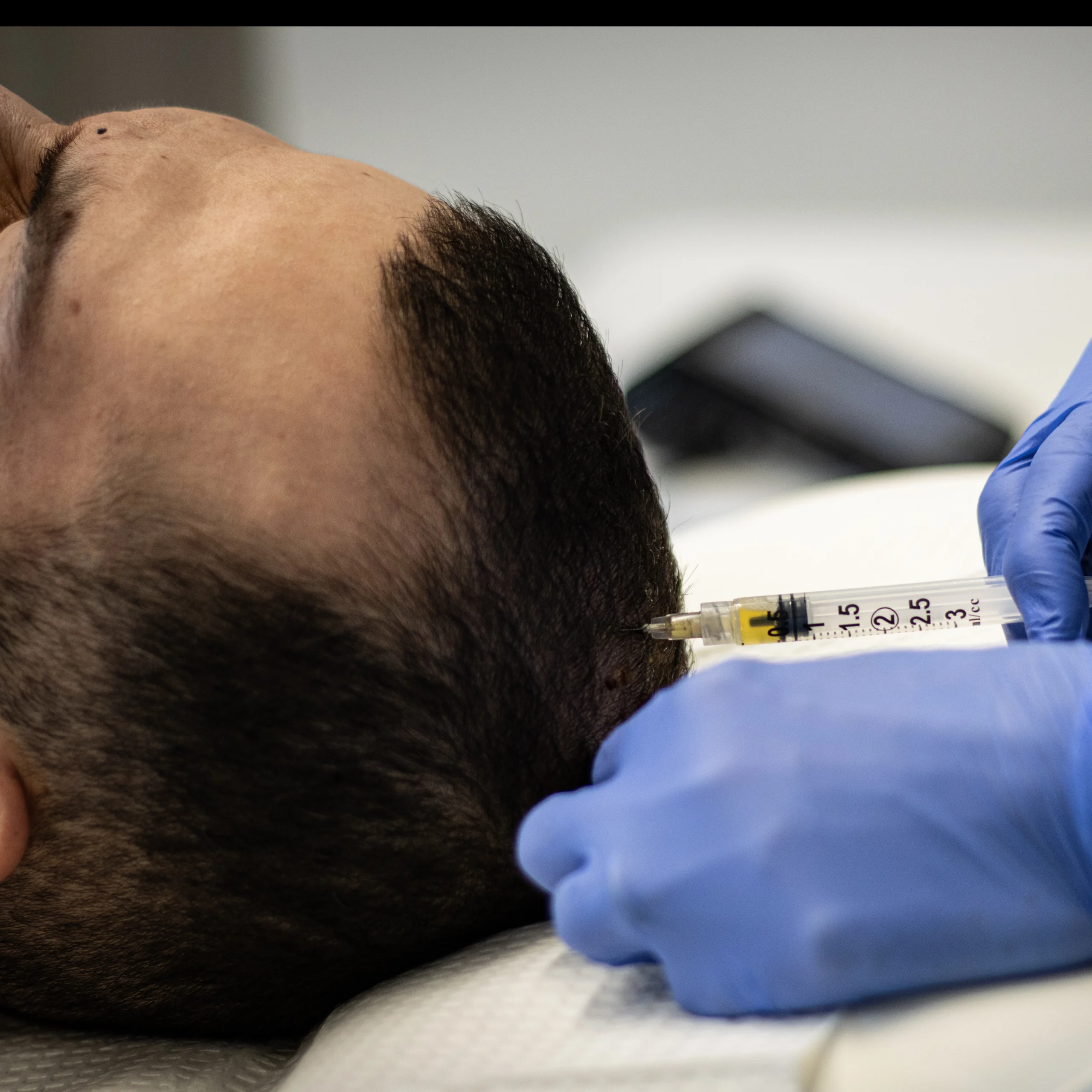 Restorative treatment consultation at Cyrus Cosmetics Fresno