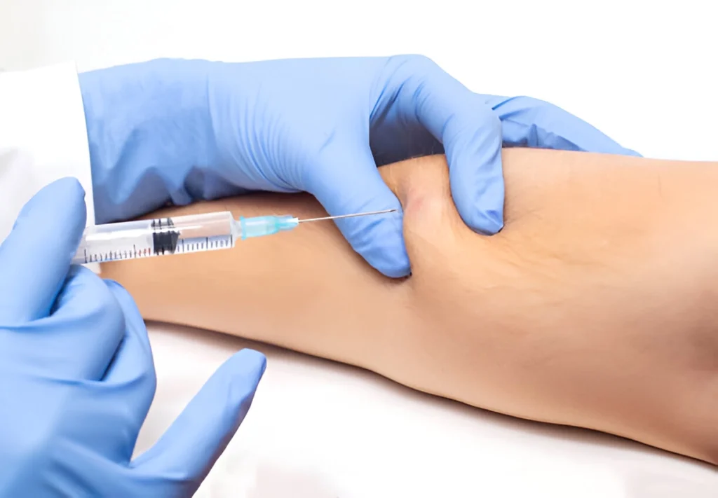 subcutaneous (Sub-Q) injection