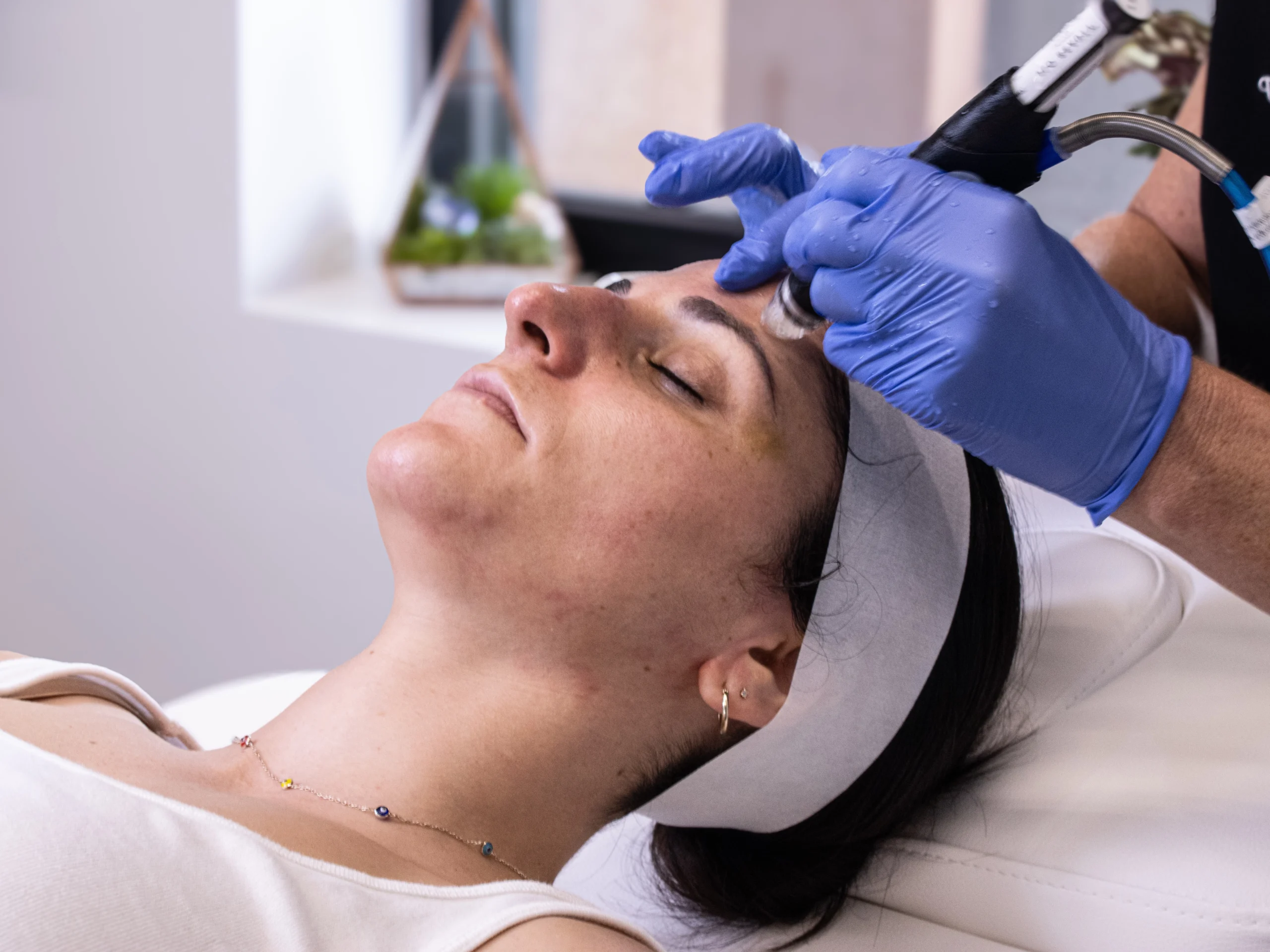 Advanced skin rejuvenation treatment at Cyrus Cosmetics Fresno