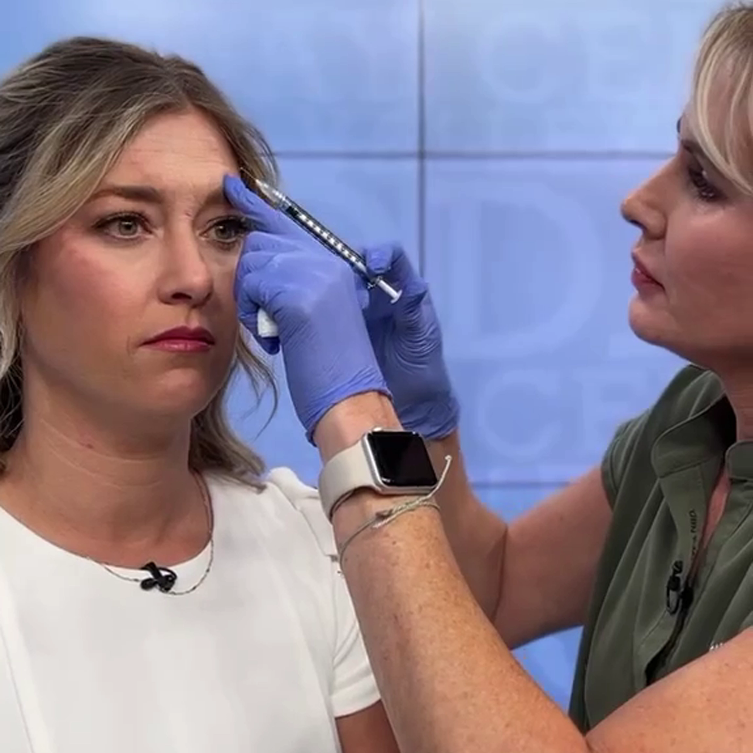 Botox wrinkle relaxer treatment in Fresno, CA – Cyrus Cosmetics