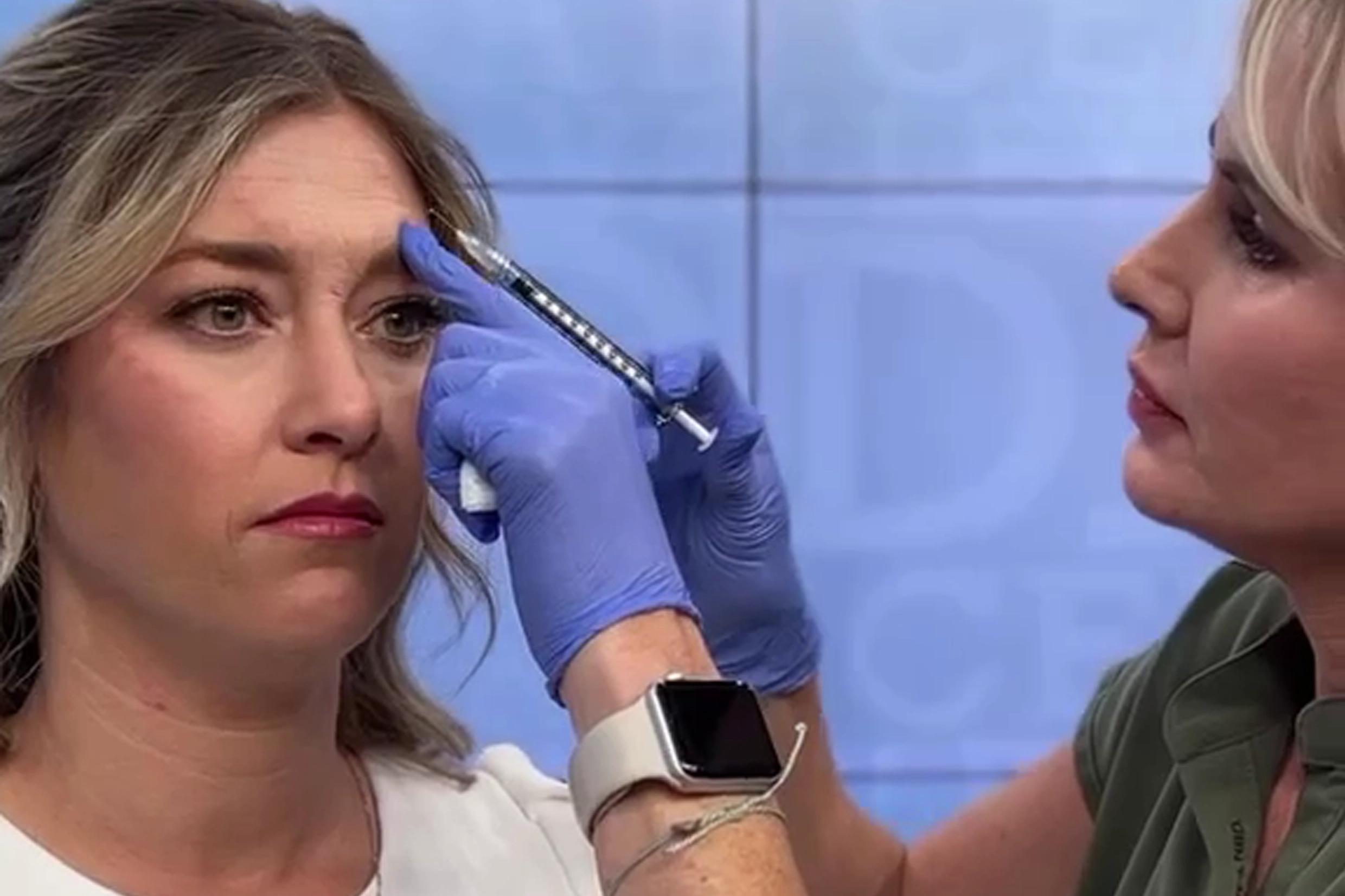 Botox injection performed by Nurse Practitioner at Cyrus Cosmetics Fresno