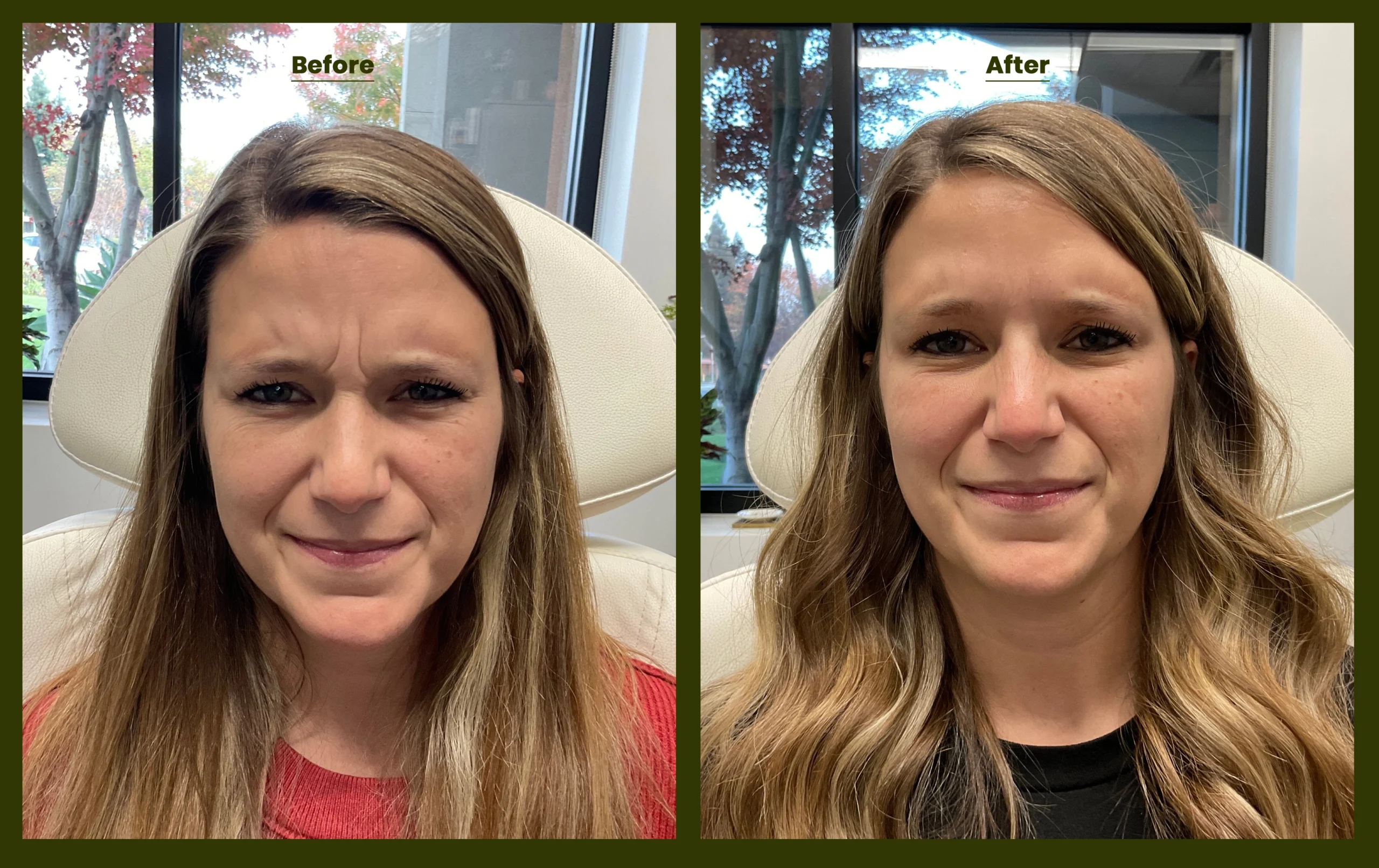 Jeuveau demonstrations at Cyrus Cosmetics