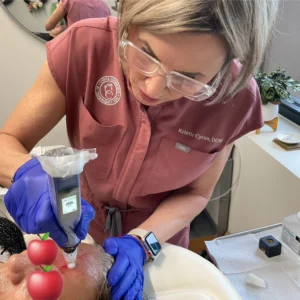 Microneedling includes complimentary PRP + GHK-Cu Injection + Rejuvenating Mask