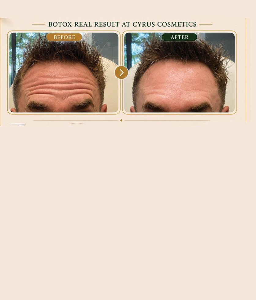 Back to School Botox Special