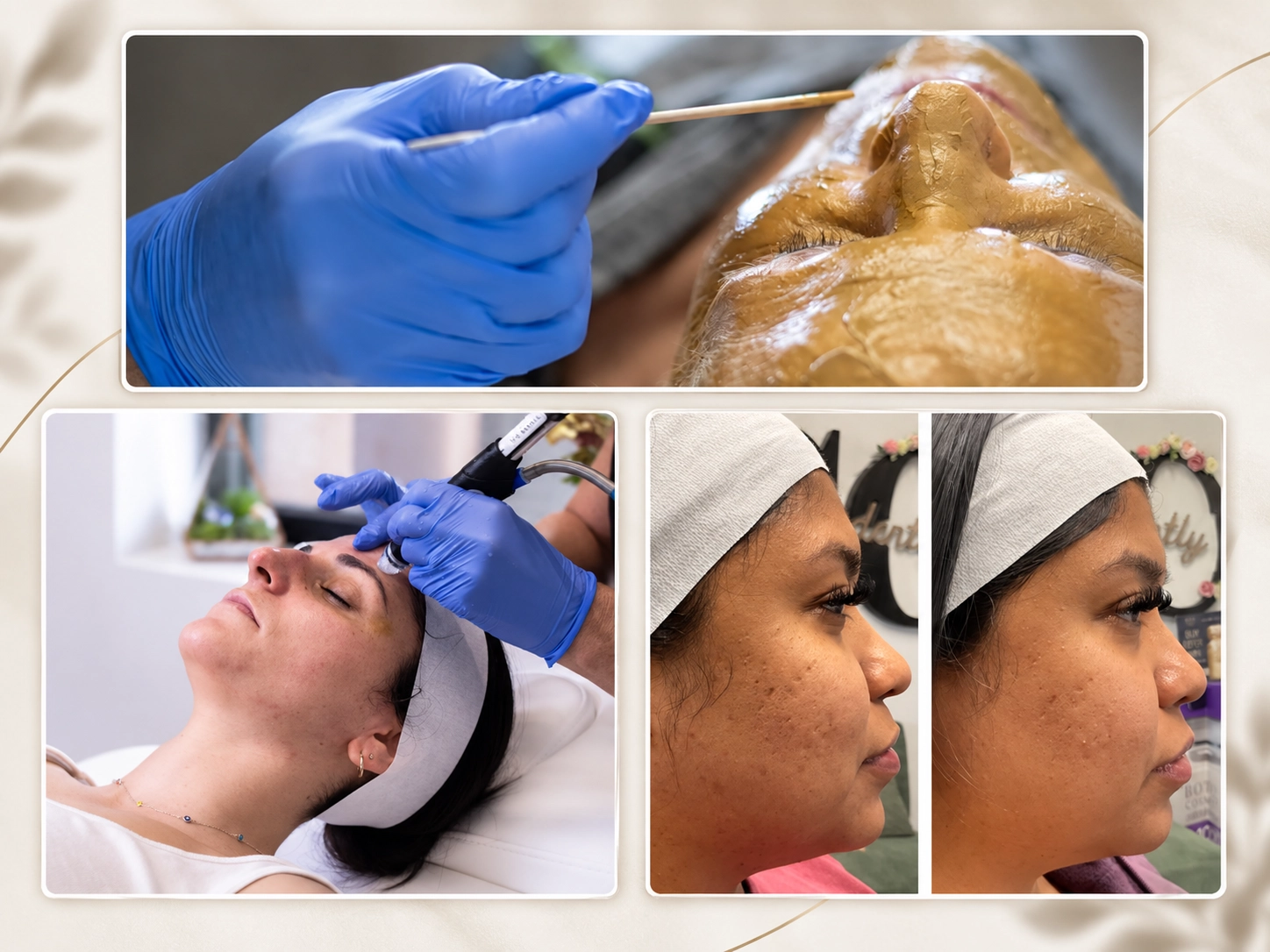 Skin rejuvenation facial treatment at Cyrus Cosmetics Fresno