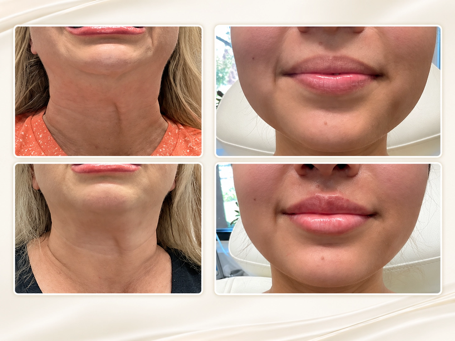 Nurse injector performing cosmetic injectable treatment at Cyrus Cosmetics Fresno