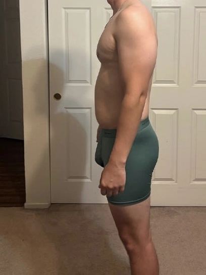 Body appearance after a peptide-assisted weight management journey