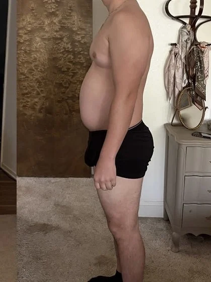 Body appearance before a peptide-assisted weight management journey