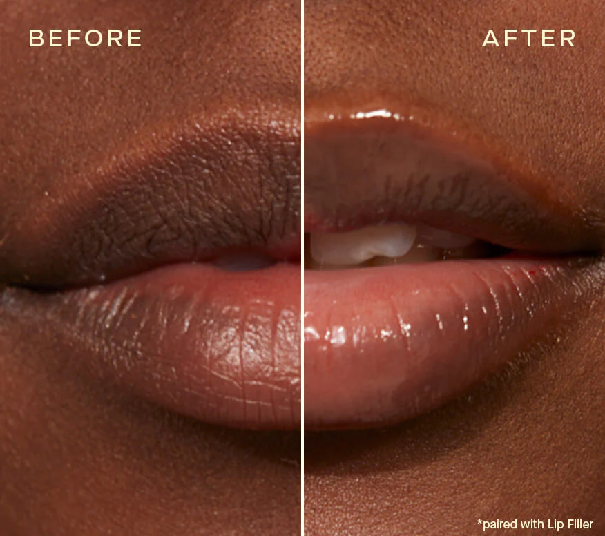 Lip Conditioner with Vitamin E: Nourish Your Lips - Image 5
